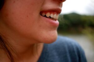 Le guide des soins de la peau avec les huiles Terre Délice 5 peau acnéique